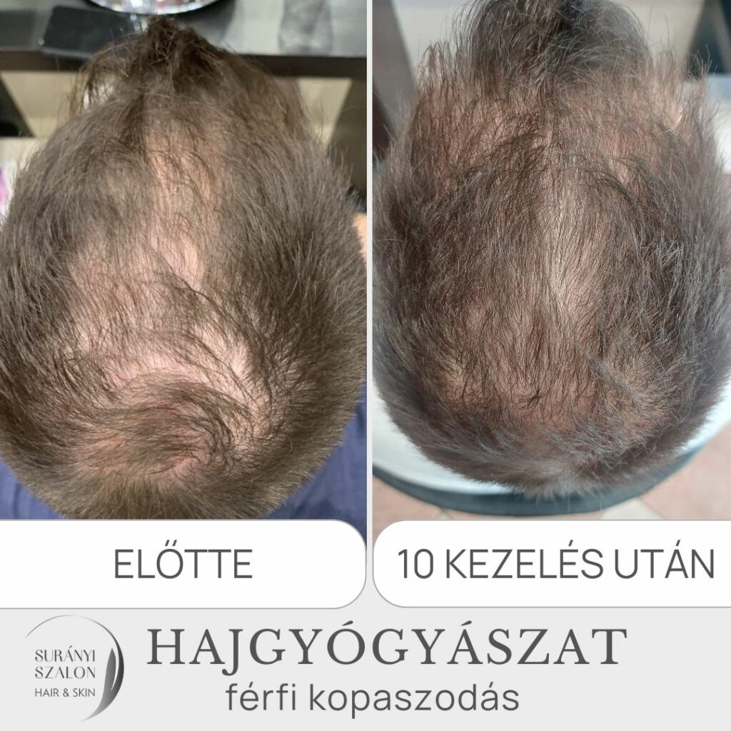 hajgyógyászat-budapest-surányi-szalon