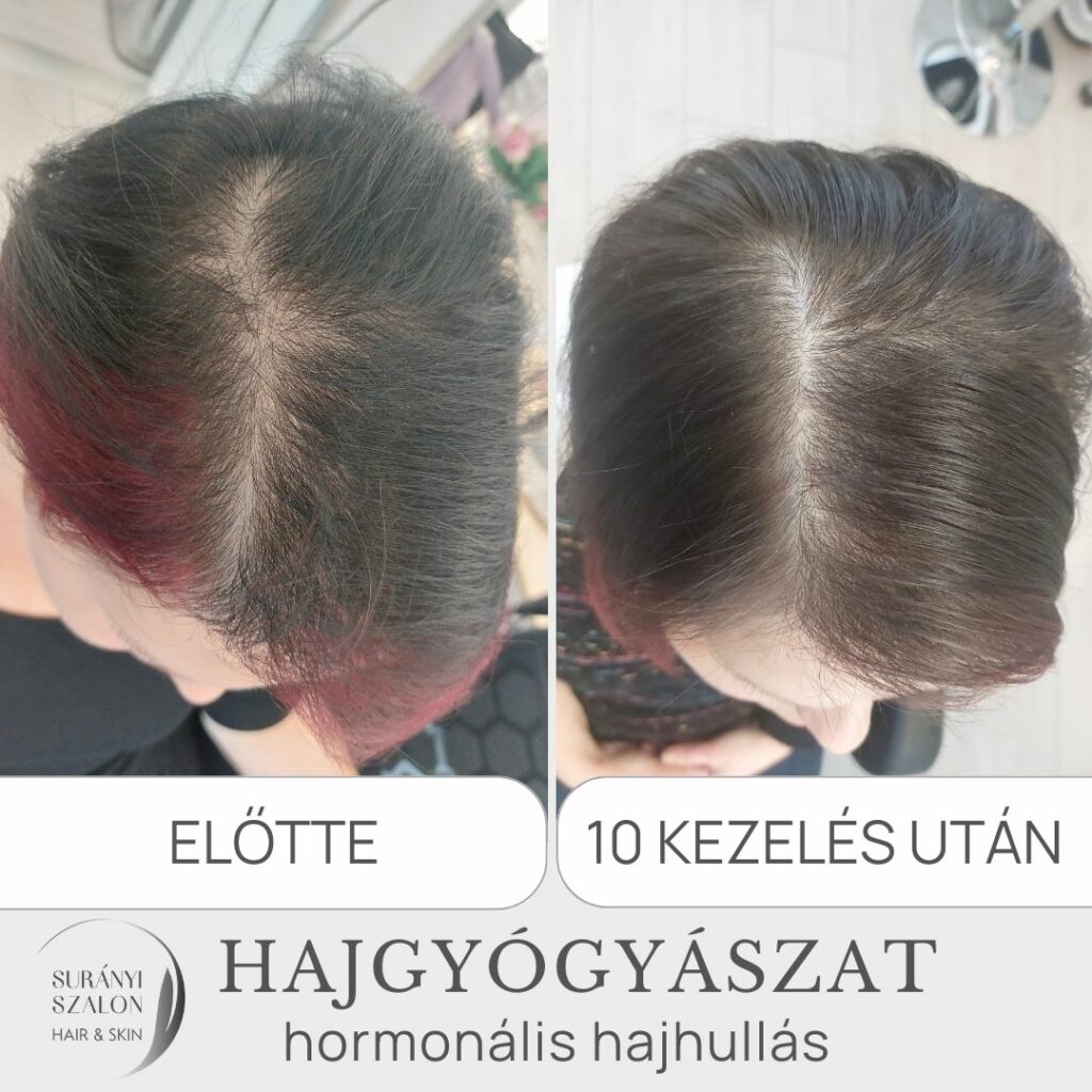hajgyógyászat-budapest-surányi-szalon